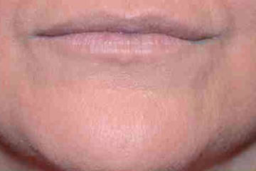 main_64_1_LA-P03-A01