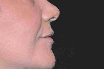 main_64_2_LA-P03-A02