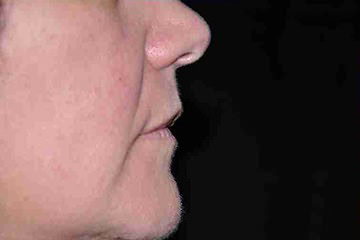 main_64_2_LA-P03-B02